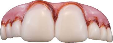 Megabucks Fake Teeth