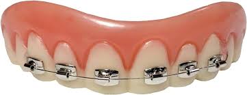 Braces Fake Teeth